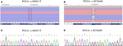 A Novel PCCA Mutation in a Patient With Late-Onset Propionic Acidemia Identified by Genetic Diagnosis Panel